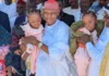 Tagwayen da aka haife su a haɗe ƴan Kano sun dawo gida bayan nasarar aikin raba su a Saudiyya Separated cojoined twins 750x430