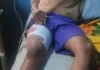 ‘Yan sanda sun kama kwamishinan muhalli na Osun kan harbi a wurin taron gangamin APC One of the injured 750x306