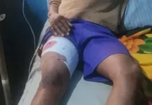 ‘Yan sanda sun kama kwamishinan muhalli na Osun kan harbi a wurin taron gangamin APC One of the injured 750x306