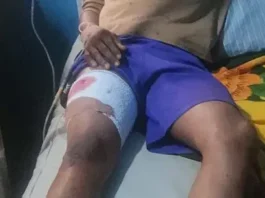 ‘Yan sanda sun kama kwamishinan muhalli na Osun kan harbi a wurin taron gangamin APC One of the injured 750x306