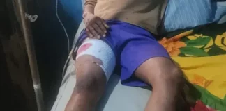 ‘Yan sanda sun kama kwamishinan muhalli na Osun kan harbi a wurin taron gangamin APC One of the injured 750x306